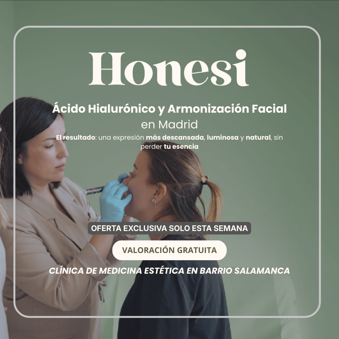 Diseño de creatividades